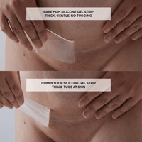 Silicone gel scar strips | Bare mum